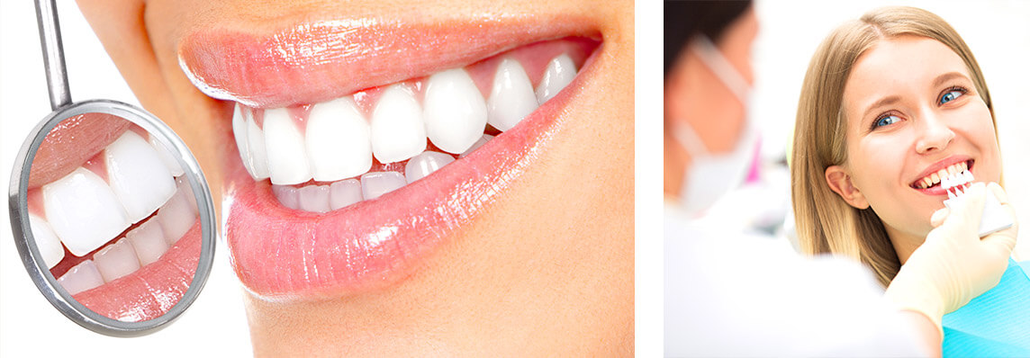 Bleaching in München Bleaching in München